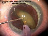 Nuclear Emulsification